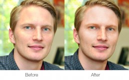 skin tone corrections